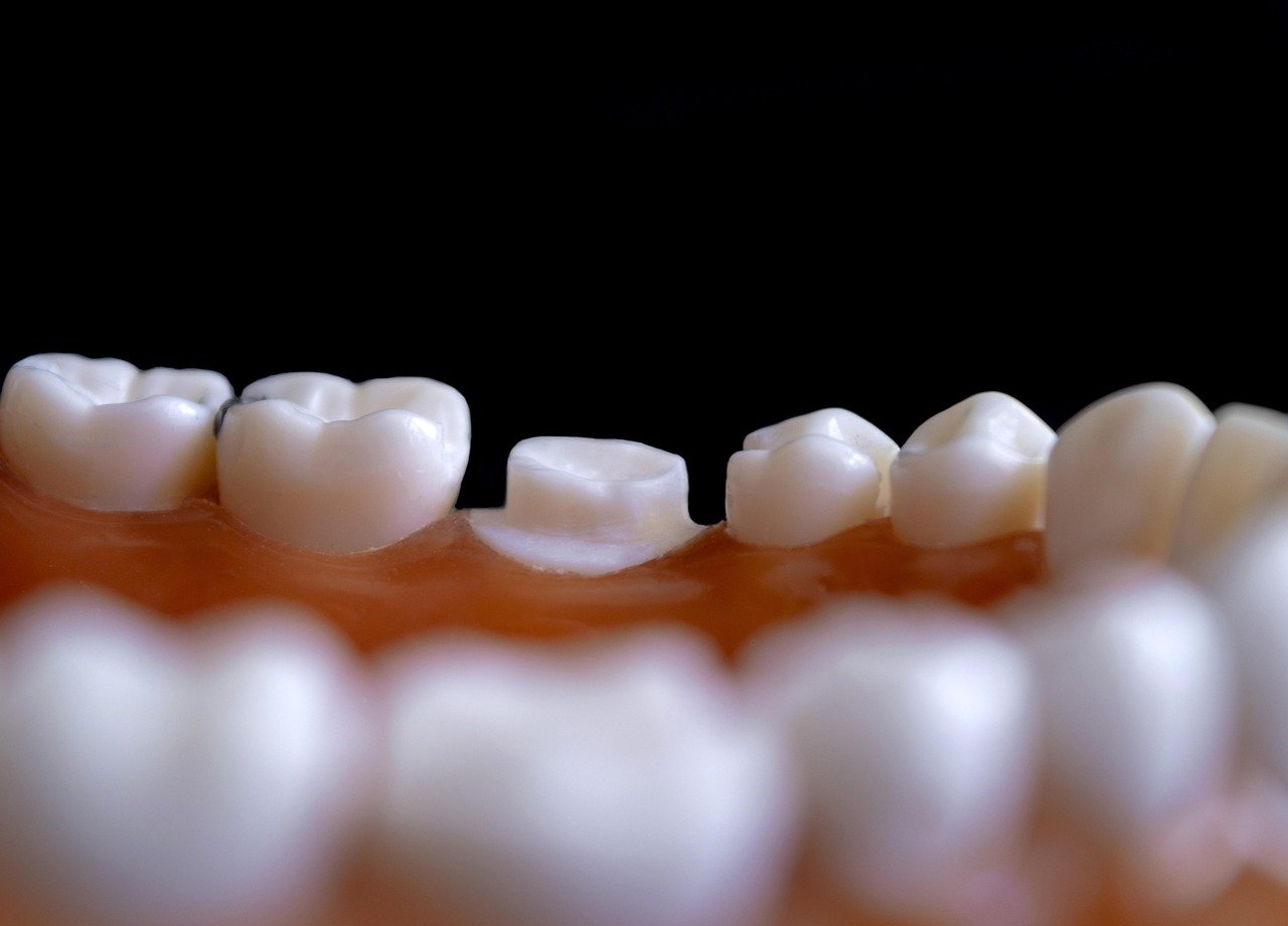 Preventing Gum Disease at Home